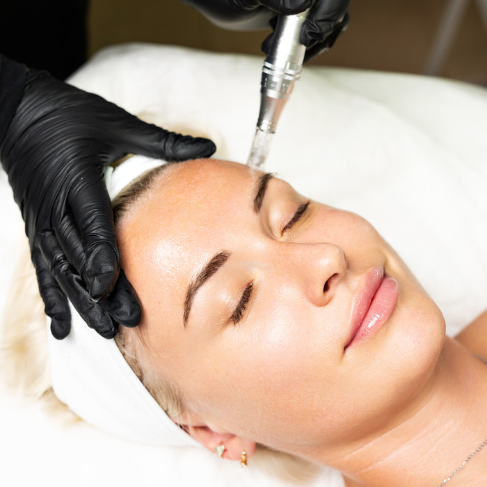 Microneedling Temecula Hormone & Aesthetics