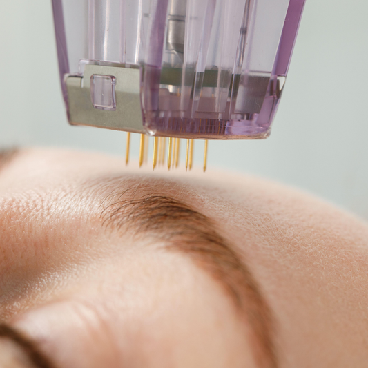 Microneedling Temecula Hormone & Aesthetics