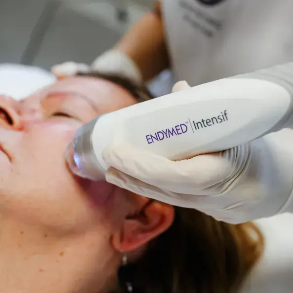 RF Microneedling - Temecula Hormone & Aesthetics