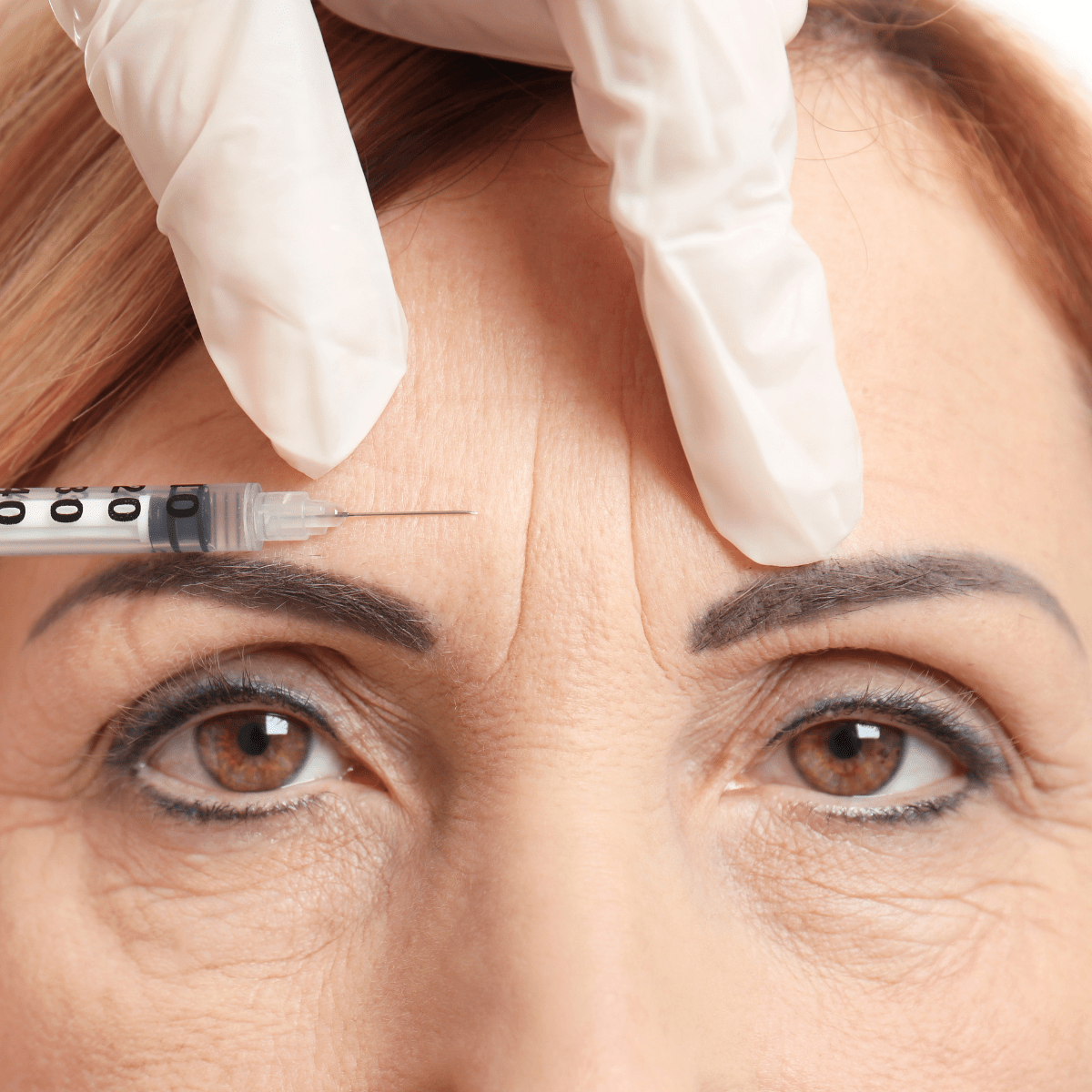 B - Tox & Fillers at Temecula Hormone & Aesthetics - Temecula Hormone & Aesthetics