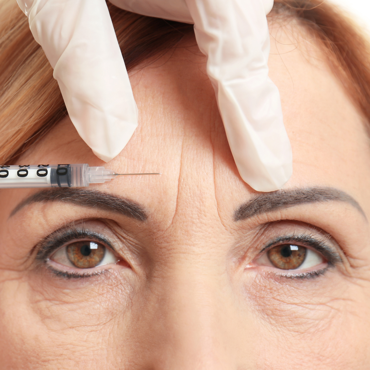 B-Tox & Fillers at Temecula Hormone & Aesthetics