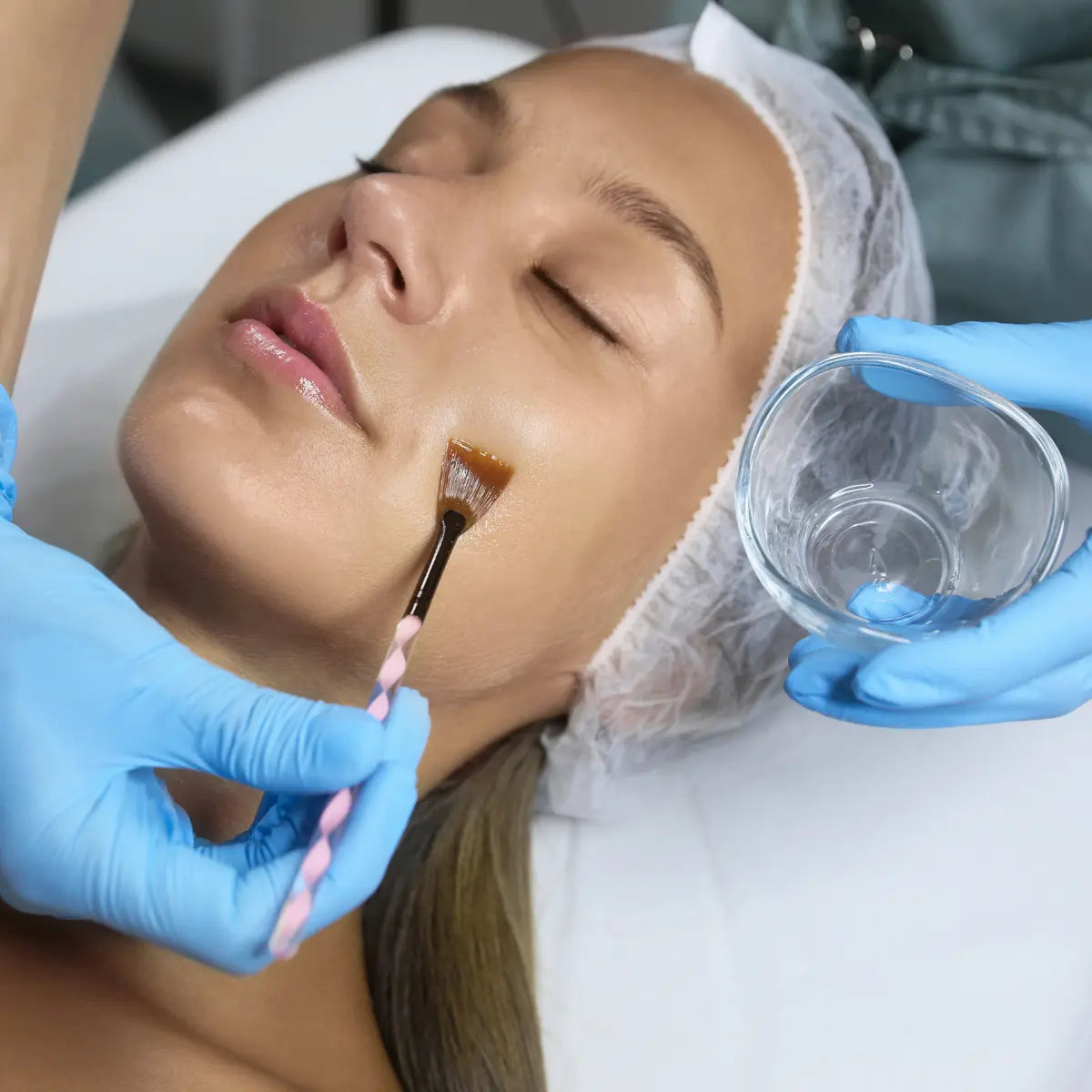 Chemical Peels at Temecula Hormone & Aesthetics - Temecula Hormone & Aesthetics