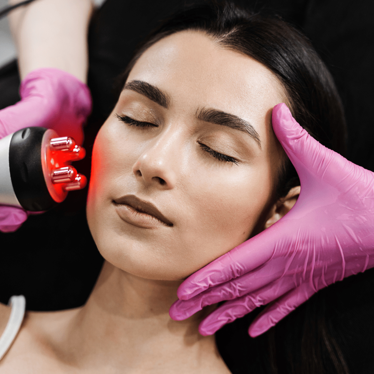 EndyMed Pure RF Skin Tightening at Temecula Hormone & Aesthetics - Temecula Hormone & Aesthetics