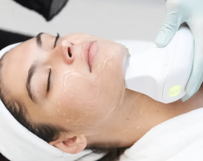 EndyMed Pure RF Skin Tightening at Temecula Hormone & Aesthetics - Temecula Hormone & Aesthetics