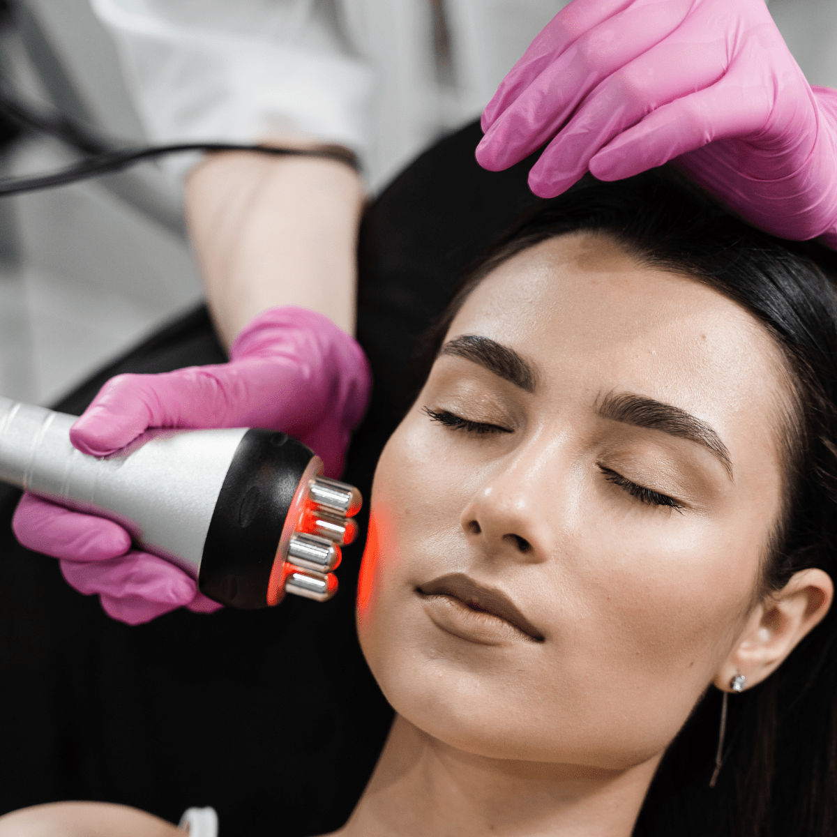 EndyMed Pure RF Skin Tightening at Temecula Hormone & Aesthetics - Temecula Hormone & Aesthetics