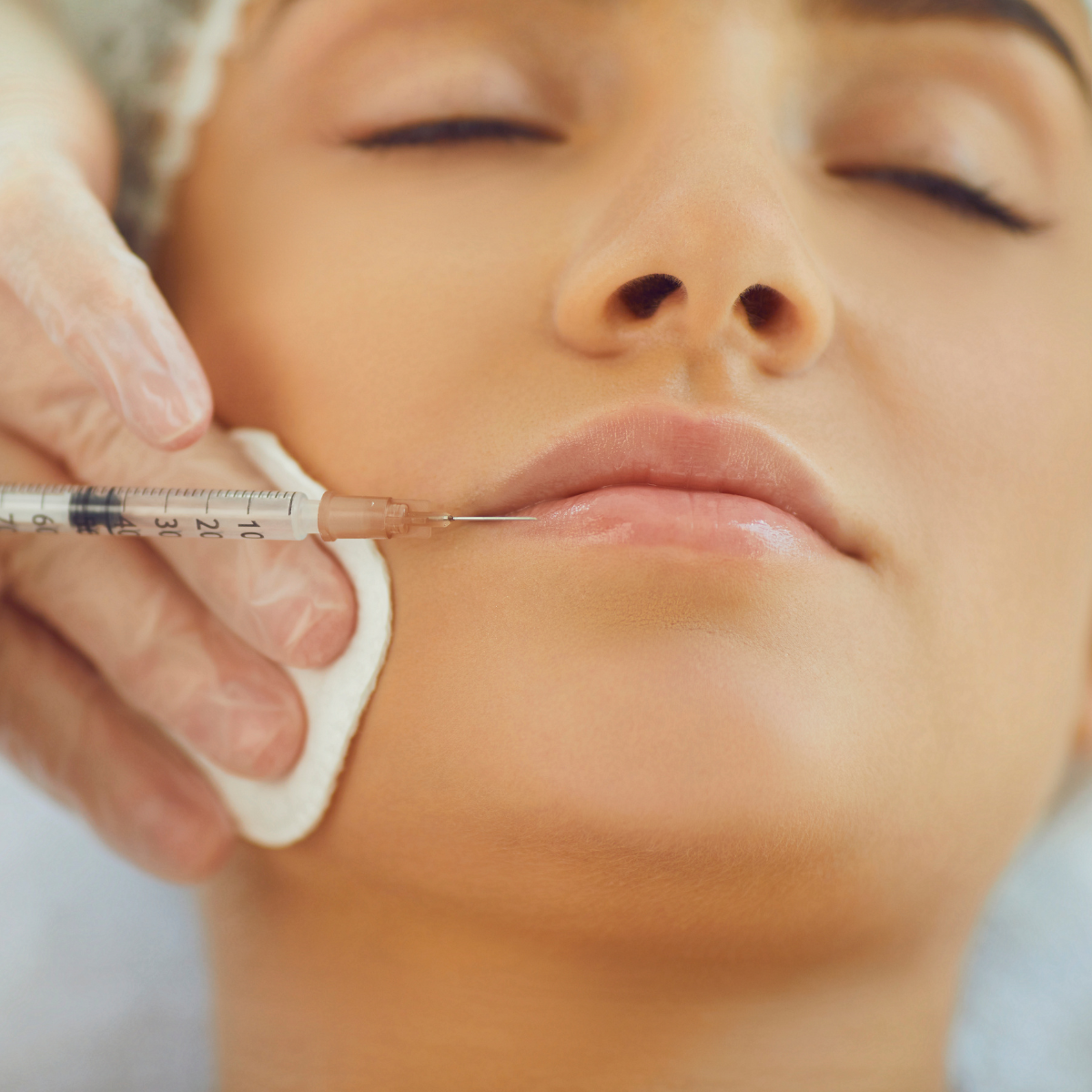 B-Tox & Fillers at Temecula Hormone & Aesthetics