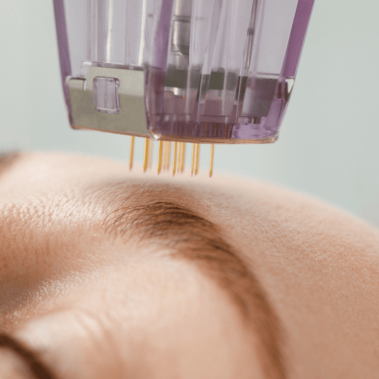 Microneedling at Temecula Hormone & Aesthetics - Temecula Hormone & Aesthetics