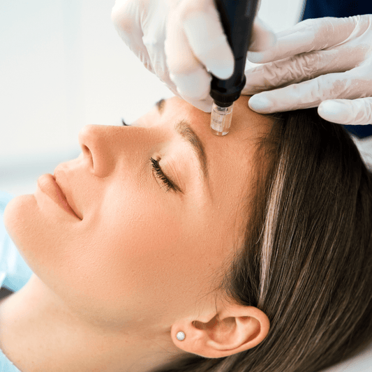 NanoNeedling at Temecula Hormone & Aesthetics - Temecula Hormone & Aesthetics