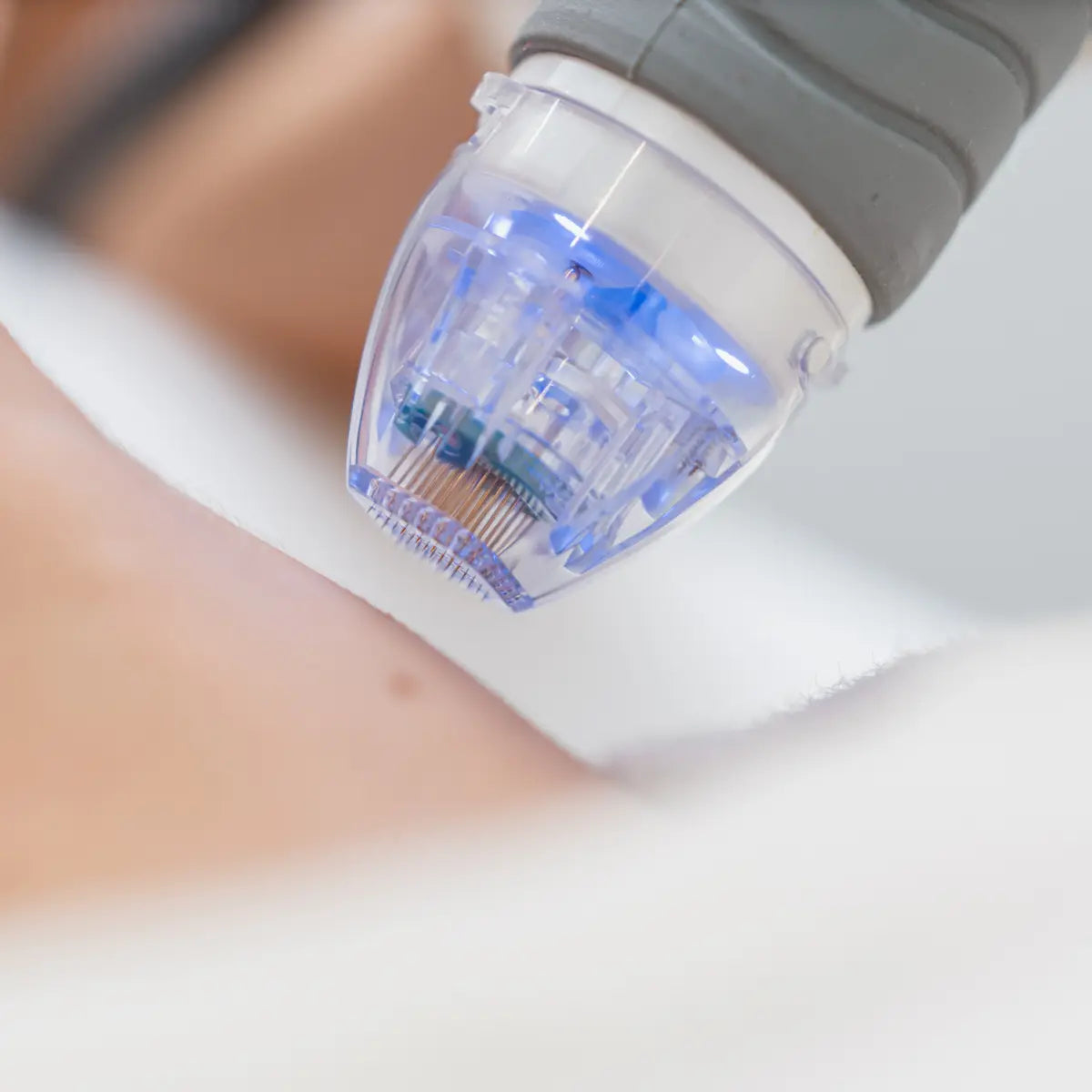 RF Microneedling at Temecula Hormone & Aesthetics - Temecula Hormone & Aesthetics
