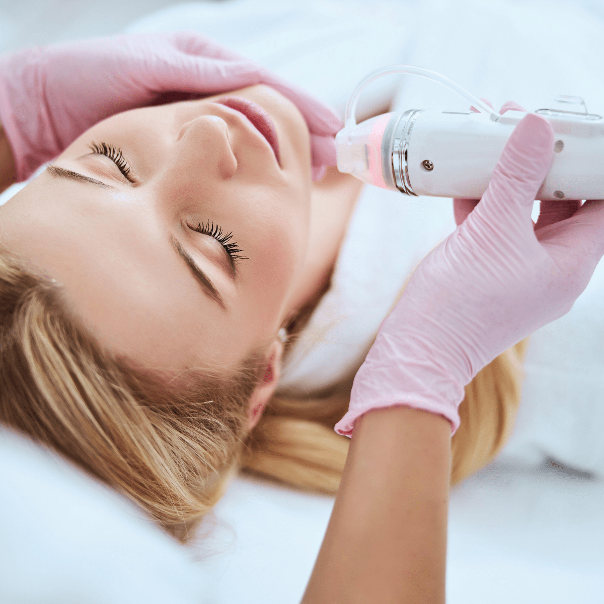 RF Microneedling at Temecula Hormone & Aesthetics - Temecula Hormone & Aesthetics
